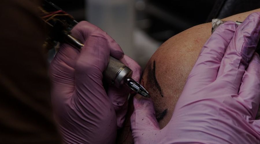 Eliminación de tatuajes mediante láser 